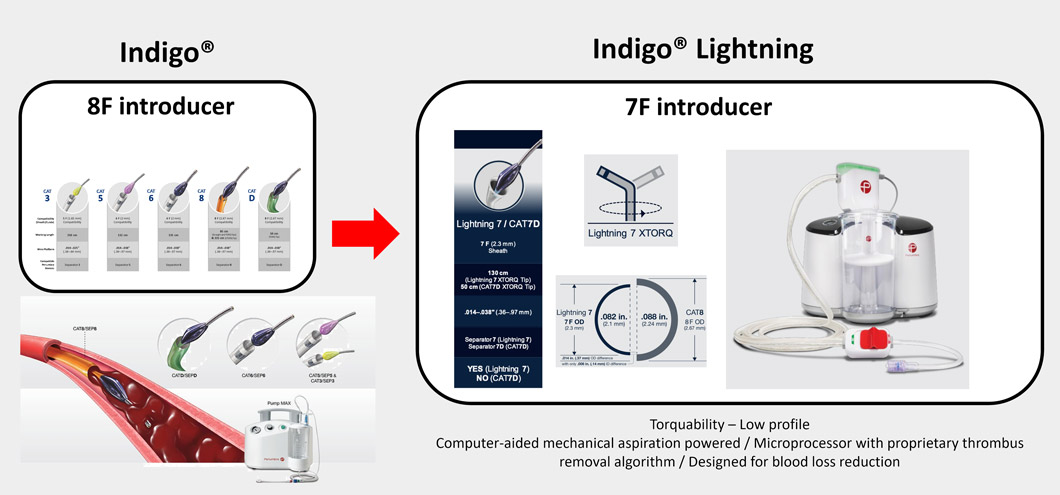Thrombo-aspiration Penumbra Indigo® Lightning / Cat7