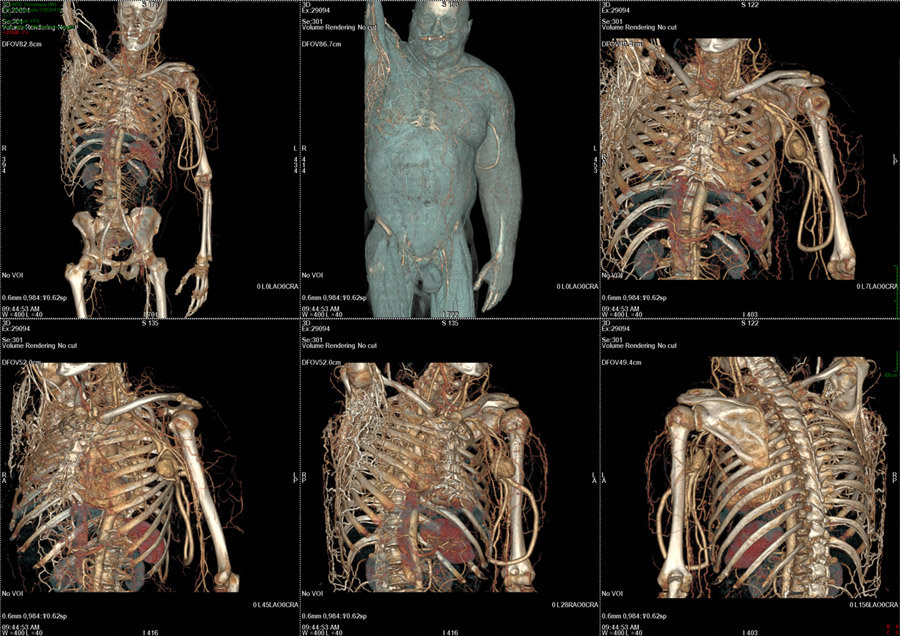 Superior Body Scan