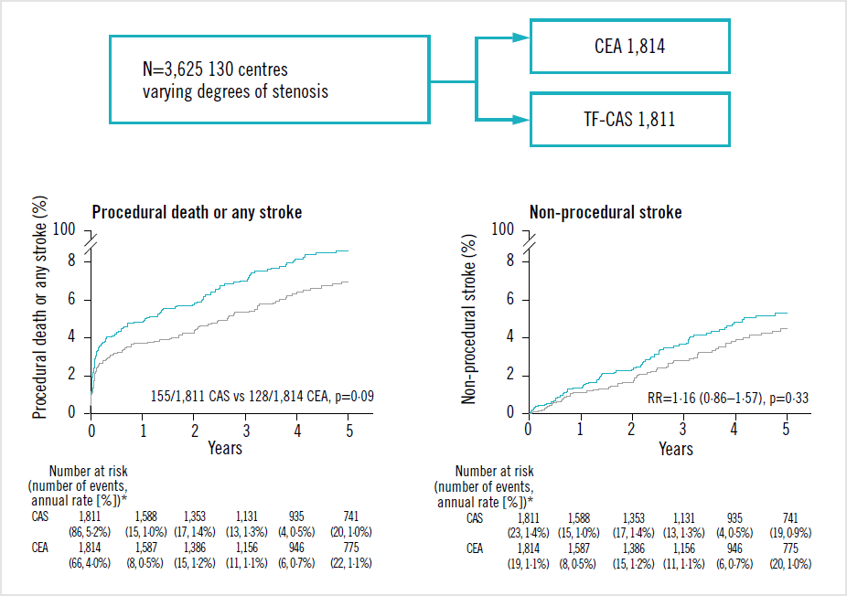 ACST-2 trial - Second asymptomatic carotid surgery trial: a randomised comparison of carotid artery stenting versus carotid endarterectomy