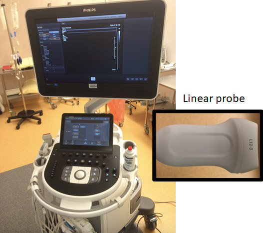 Duplex scan guided puncture