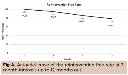 Figure 4: Popliteal access for iliofemoral occlusive disease in the office-based catheter laboratory