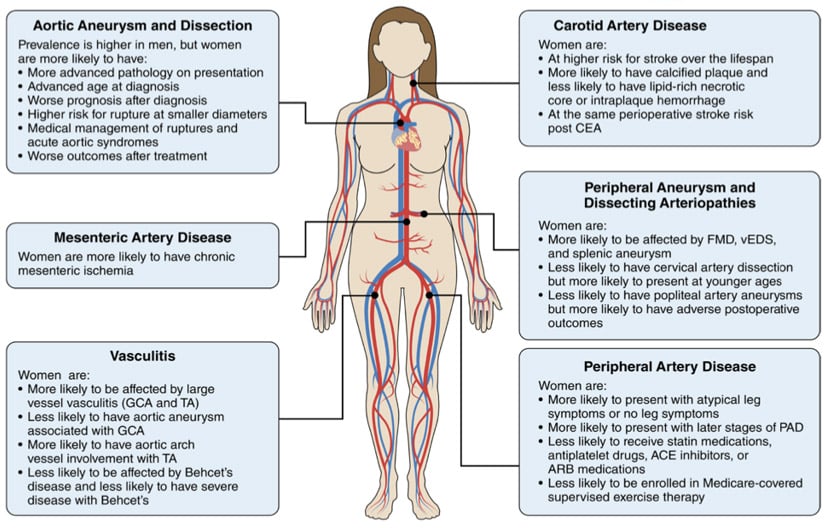 Sex differences in peripheral vascular disease