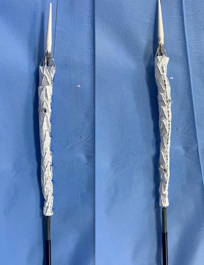 Total endo‑aortic repair for a triple‑lumen post‑dissection TAAA: Overview of the customized endovascular strategy