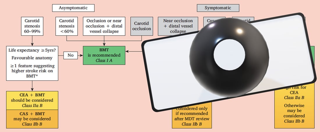 Carotid Stenosis