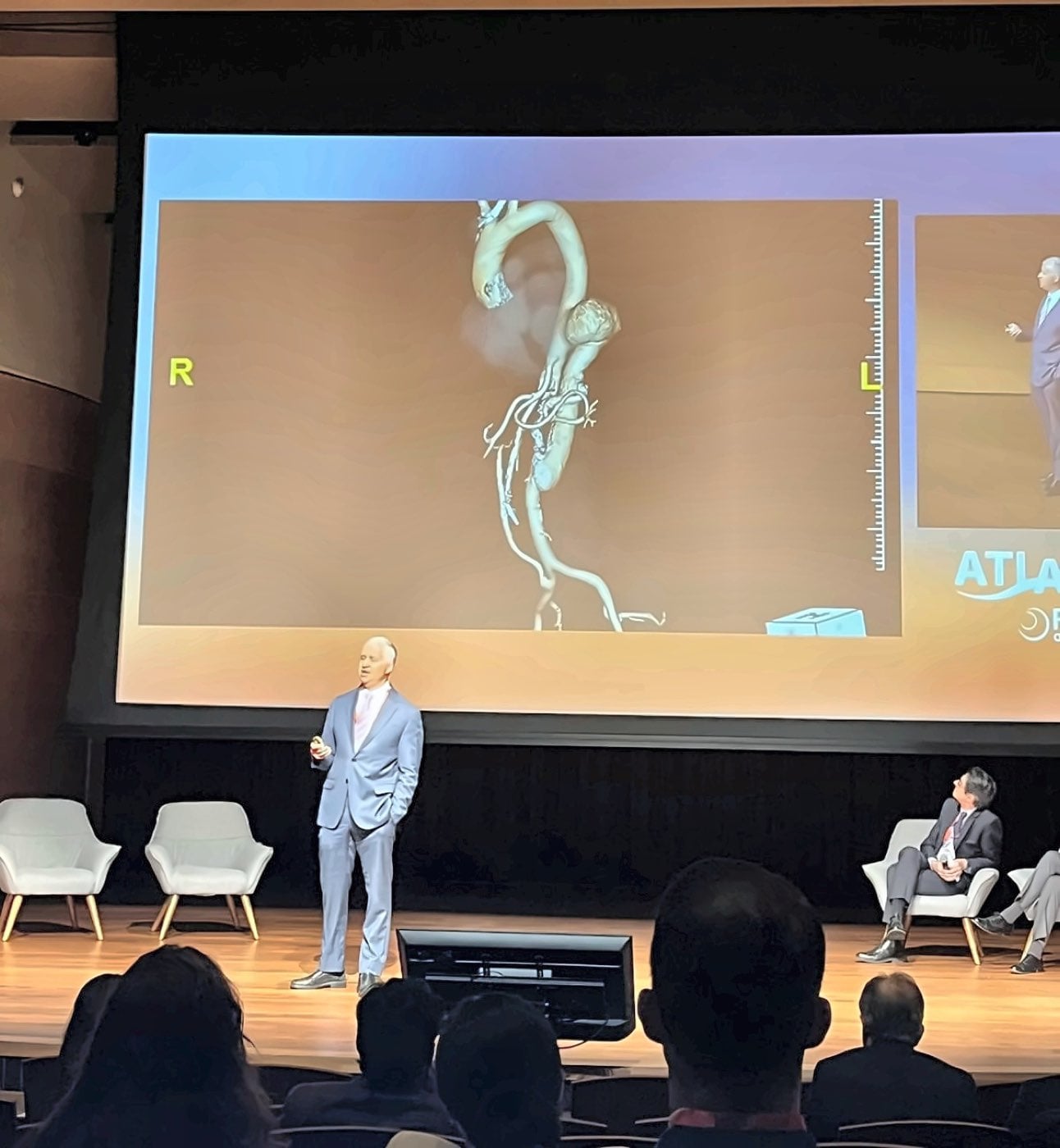 A speaker presenting a 3D aortic reconstruction on stage at ATLAS-PVI Aortic