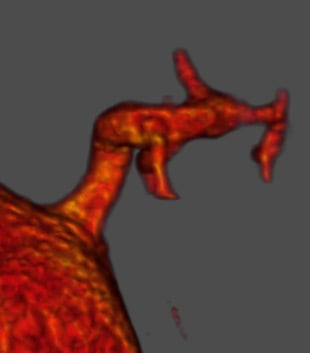 Technical drawing: Integrated bifurcation