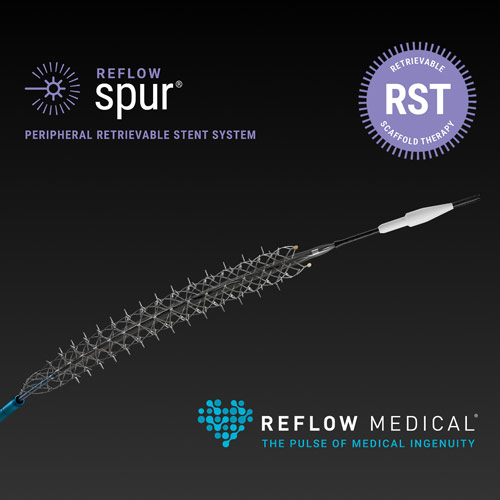 Spur Peripheral Retrievable Stent System