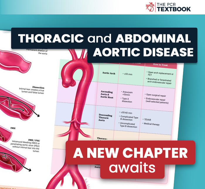 The PCR Texbook chapter on thoracic and abdominal aortic disease