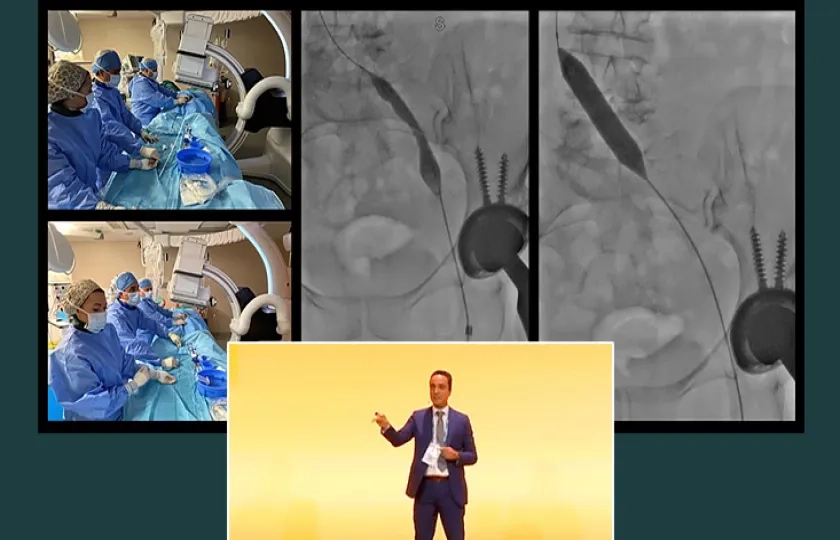 Holistic approach to venous ulceration