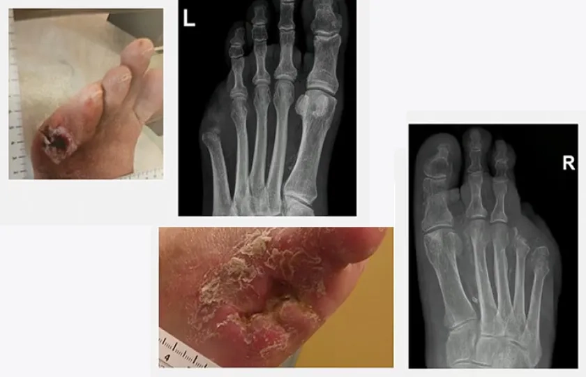 Endovascular myths: separating fact from fiction