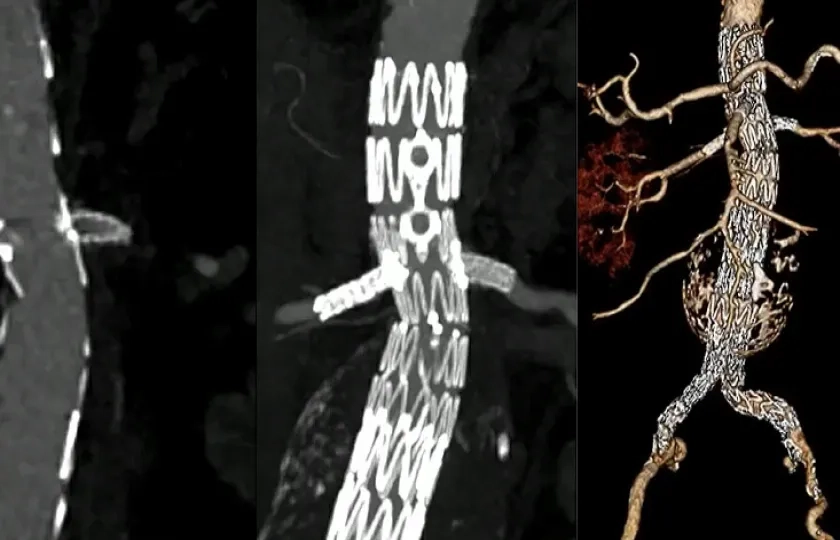 Don't make complex AAA too complex