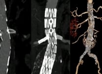 Don't make complex AAA too complex