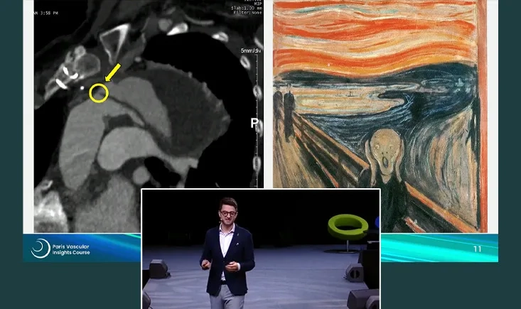 Interventional nightmares