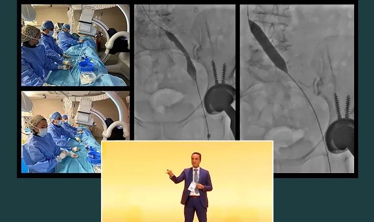 Holistic approach to venous ulceration