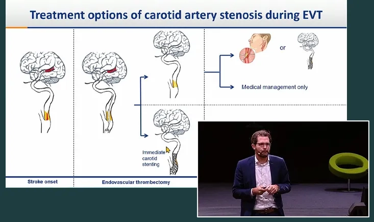 Carotid updates and controversies