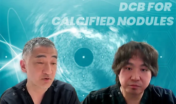  DCB for calcified nodules: key insights from the ALLIGATOR study 