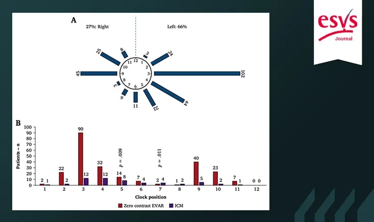 Feasibility and safety of using carbon dioxide exclusively in regular endovascular aortic aneurysm repair : results of a multicentre, prospective, zero iodine contrast endovascular aneurysm repair study 