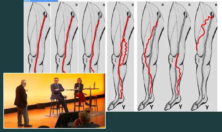 Superficial venous intervention
