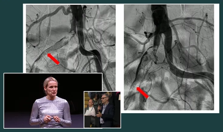 Complications and troubleshooting for peripheral vascular specialists
