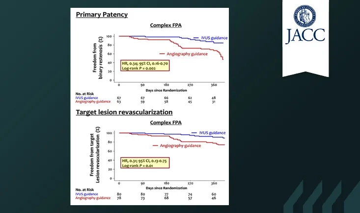 IVUS-guided vs angiography-guided drug-coated balloon angioplasty in patients with complex femoropopliteal artery disease