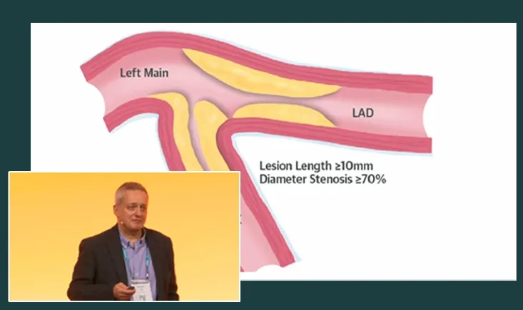 EuroPCR@PVI: bifurcation PAD endovascular management - From cardiology overview to peripheral