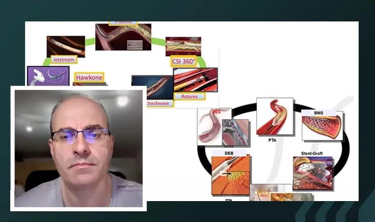 Prof. Korosoglou’s toolkit: femopop made clear