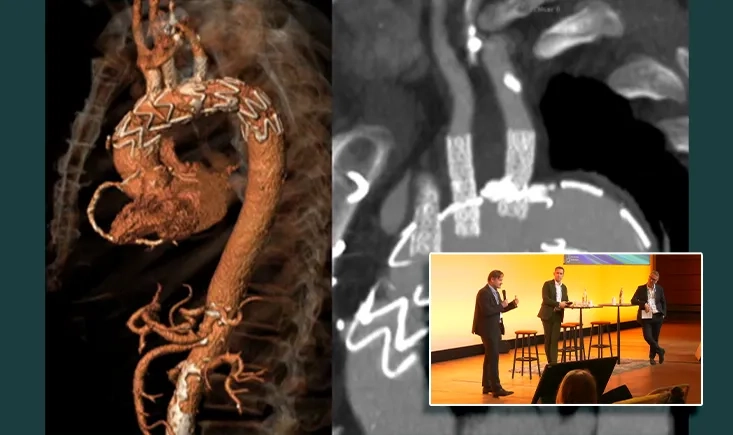 Live in a box - Aorta I