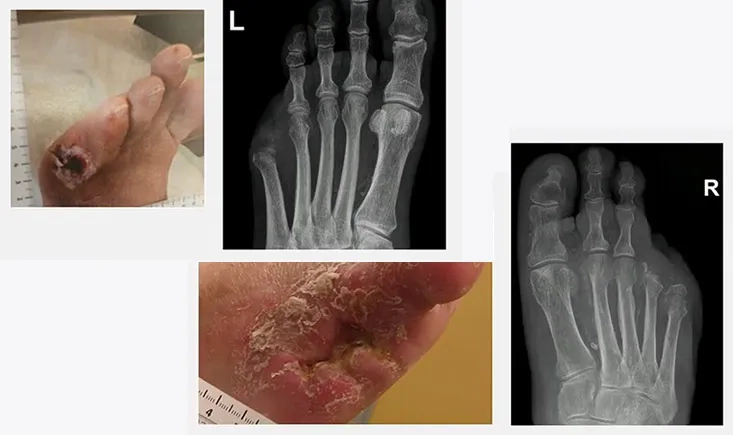 Endovascular myths: separating fact from fiction