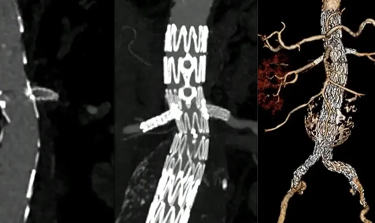 Don't make complex AAA too complex