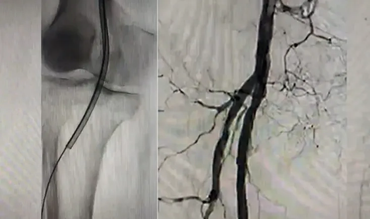 Late breaking news from Asia Pacific 