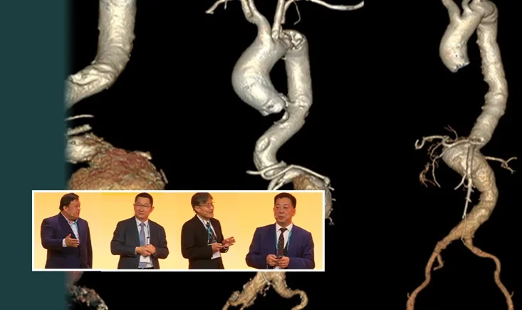 Vascular trends in APAC