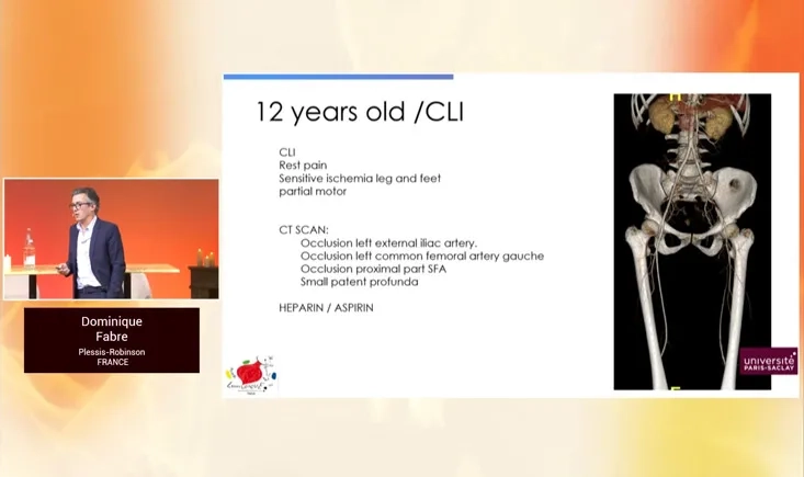 Broadening horizons of aortic repair