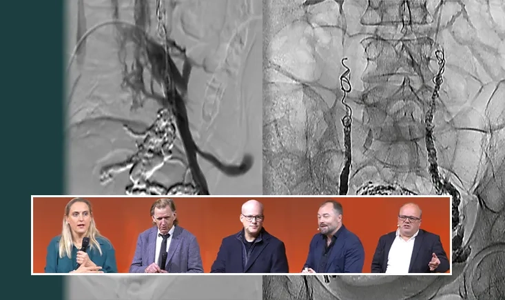 Deep venous dilemmas: unraveling complex pathologies in pelvic venous disorders
