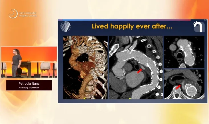 Interventional nightmares II