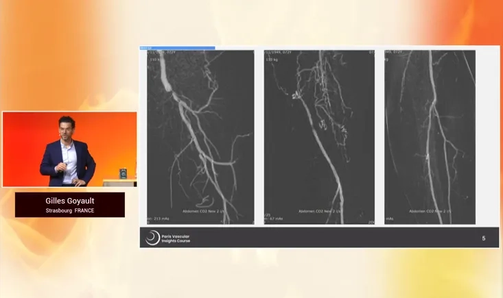 The cardiologist's point of view