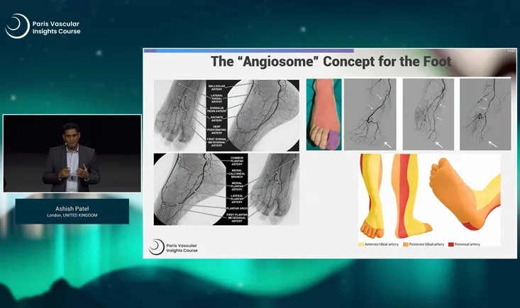 The dark sides of CLTI, but there is light at the end of the tunnel
