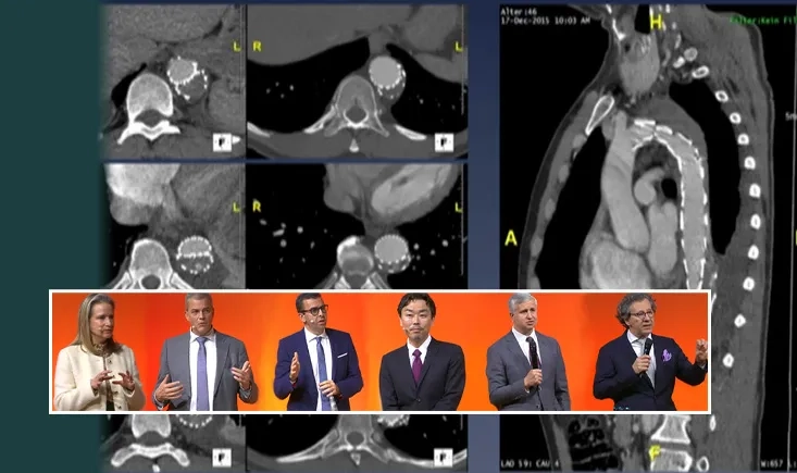 The devil in the details with dissection