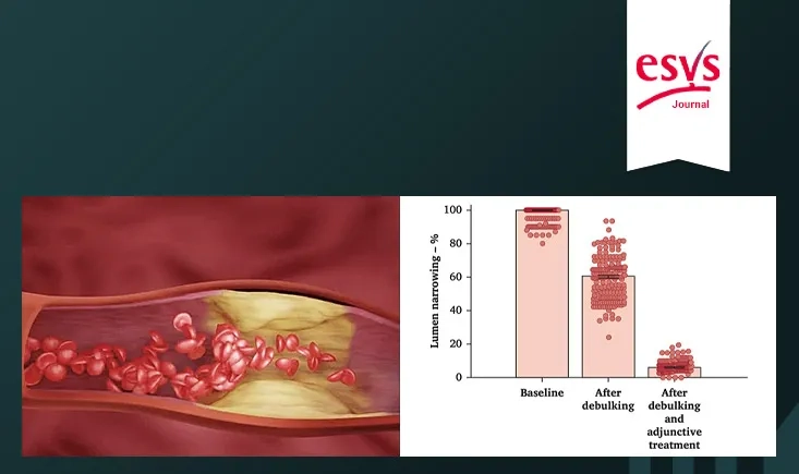 Safety and efficacy of rotational thrombectomy and drug-coated balloon angioplasty in patients with femoropopliteal in-stent restenosis and occlusions