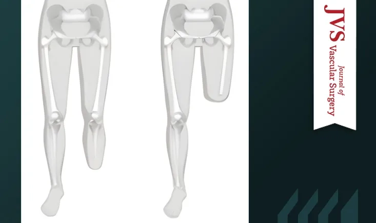 Revision of below-knee amputation stumps to a higher level in patients with peripheral vascular disease 