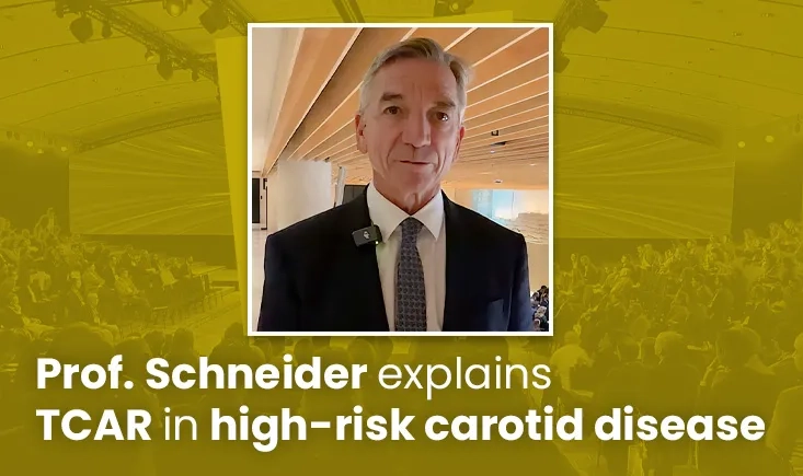 Prof. Schneider explains TCAR in high-risk carotid disease