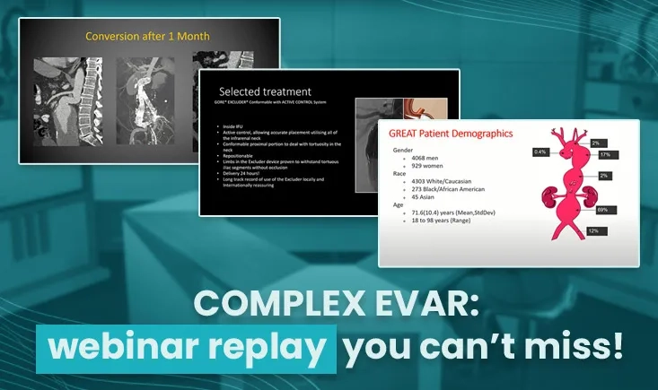 From routine to challenging – an EVAR overview based on decades of evidence and experience
