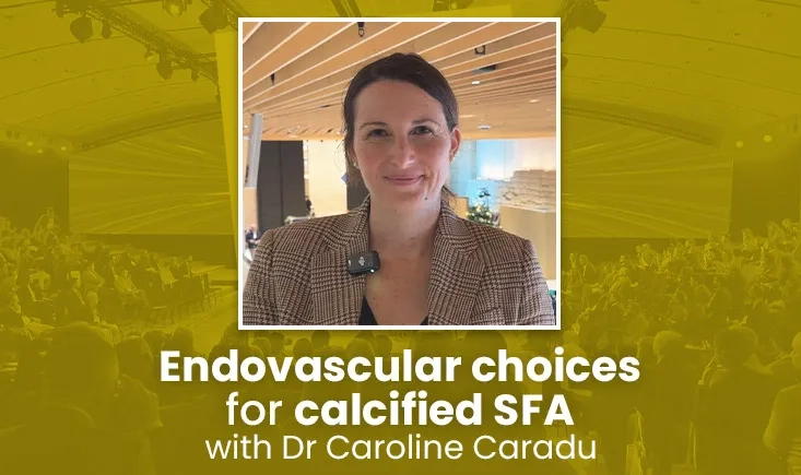 Endovascular choices for calcified SFA