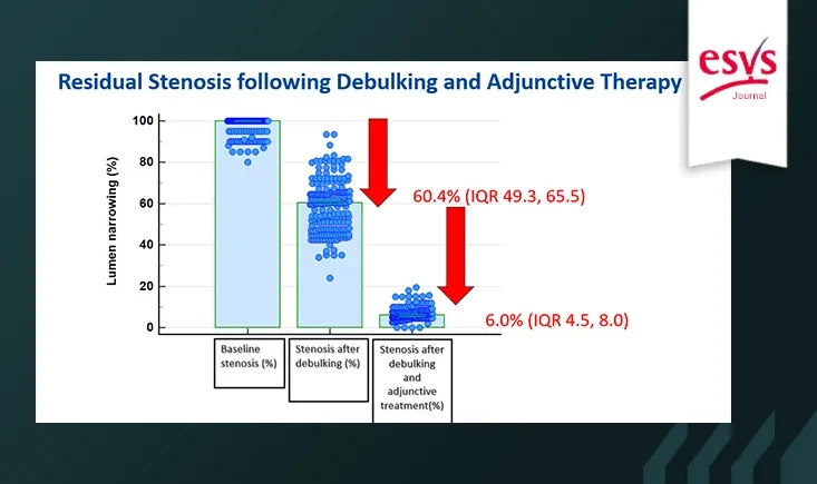 ISR management: debulking plus DCB in complex femoropopliteal disease