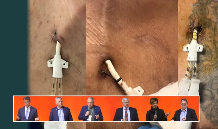 Disruption, debate, and delivery: evolving approaches to the hemodialysis lifeline