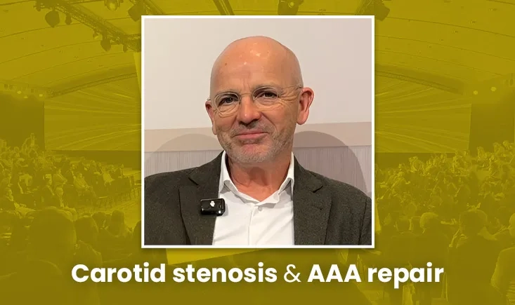 Dr Steinmetz on carotid stenosis and AAA strategy