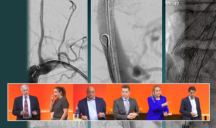 EVAR, TEVAR & Beyond: complications and lessons