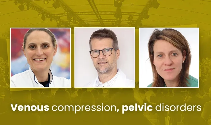 Venous disease: compression, pelvic disorders and beyond