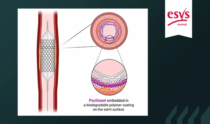 Paclitaxel-coated devices in intermittent claudication: an update from the 2024 ESVS Guidelines