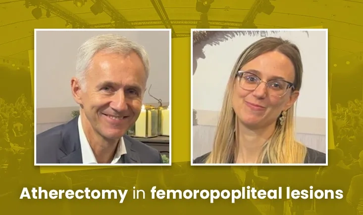 Calcified, complex, long: atherectomy in femoropopliteal lesion