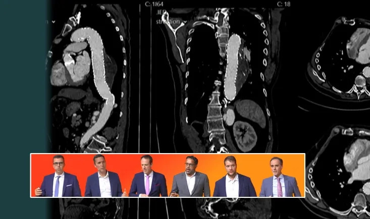 Vascular imaging: from IVUS to 4D and beyond